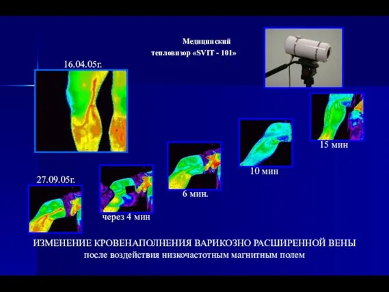 Медицинский тепловизор «SVIT - 101» 16.04.05г. 27.09.05г. через 4 мин