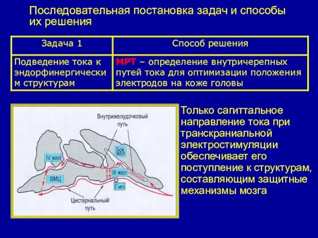 Последовательная постановка задач и способы их решения Только сагиттальное направление