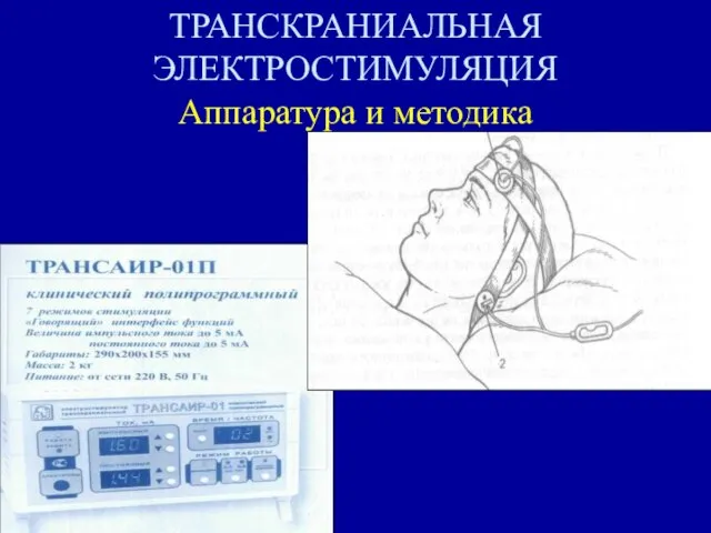 ТРАНСКРАНИАЛЬНАЯ ЭЛЕКТРОСТИМУЛЯЦИЯ Аппаратура и методика