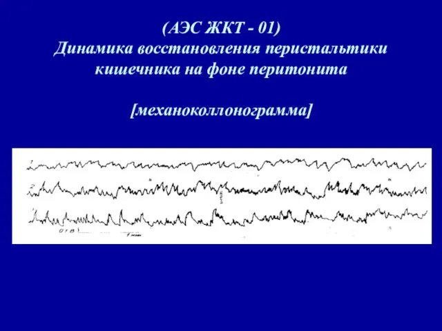 (АЭС ЖКТ - 01) Динамика восстановления перистальтики кишечника на фоне перитонита [механоколлонограмма]