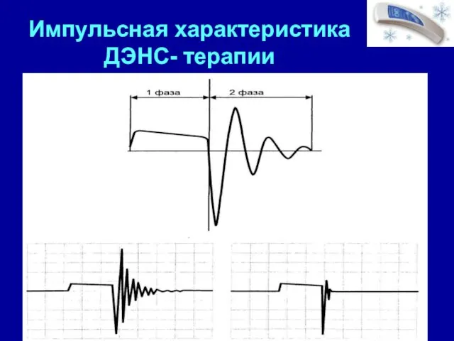 Импульсная характеристика ДЭНС- терапии