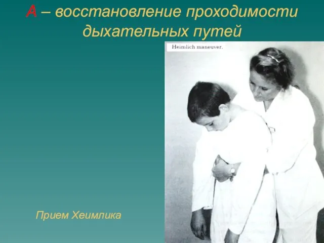 A – восстановление проходимости дыхательных путей Прием Хеимлика