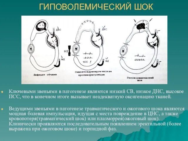 ГИПОВОЛЕМИЧЕСКИЙ ШОК Ключевыми звеньями в патогенезе являются низкий СВ, низкое ДНС, высокое ПСС,