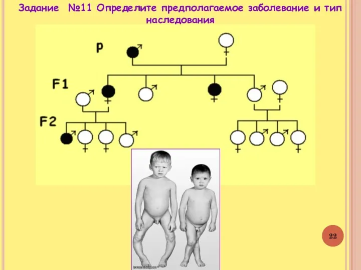 Задание №11 Определите предполагаемое заболевание и тип наследования