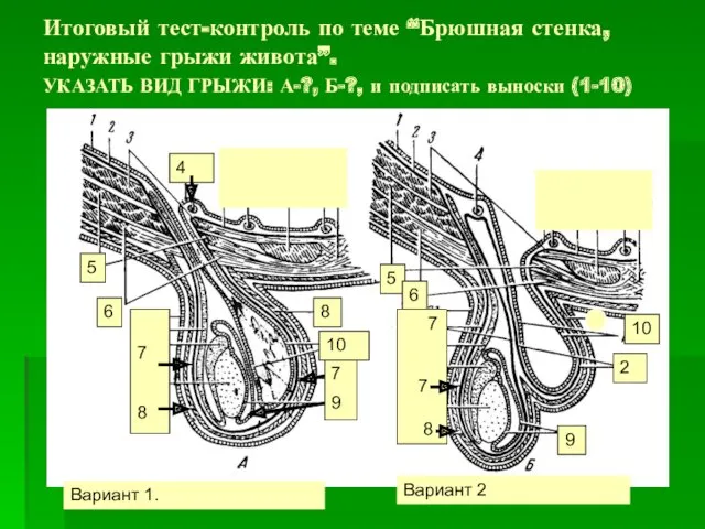 Итоговый тест-контроль по теме “Брюшная стенка, наружные грыжи живота”. УКАЗАТЬ