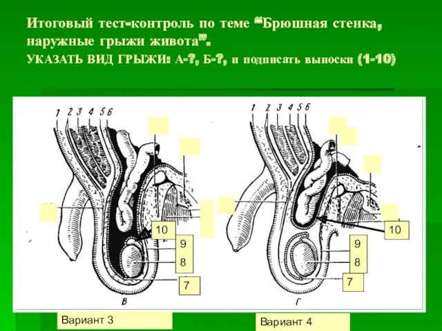 Итоговый тест-контроль по теме “Брюшная стенка, наружные грыжи живота”. УКАЗАТЬ