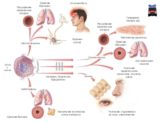 простагландины Расширение кровеносных сосудов Сужение бронхиол Нервная клетка Головная боль Расширение кровеносных сосудов