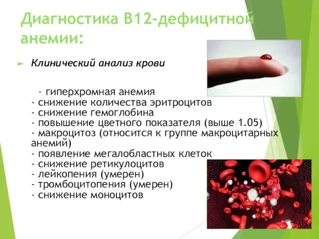 Диагностика В12-дефицитной анемии: Клинический анализ крови - гиперхромная анемия -