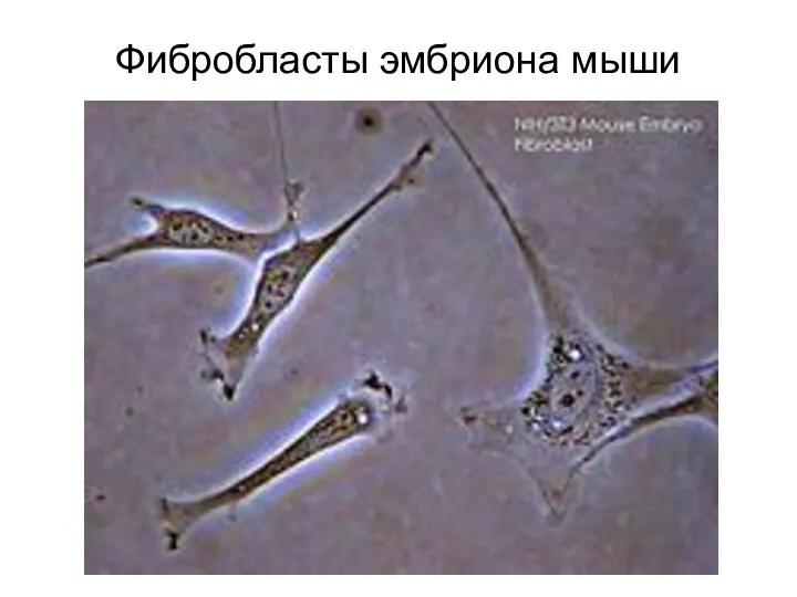 Фибробласты эмбриона мыши