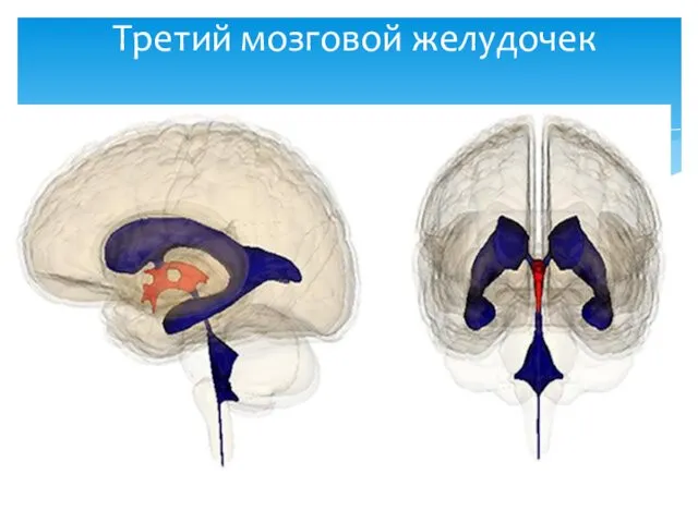 Третий мозговой желудочек