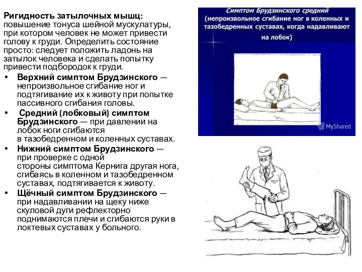 Ригидность затылочных мышц: повышение тонуса шейной мускулатуры, при котором человек