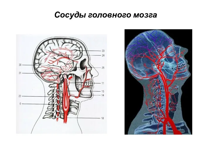 Сосуды головного мозга