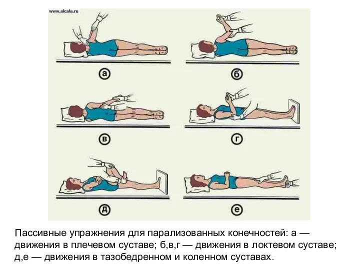 Пассивные упражнения для парализованных конечностей: а — движения в плечевом суставе; б,в,г —