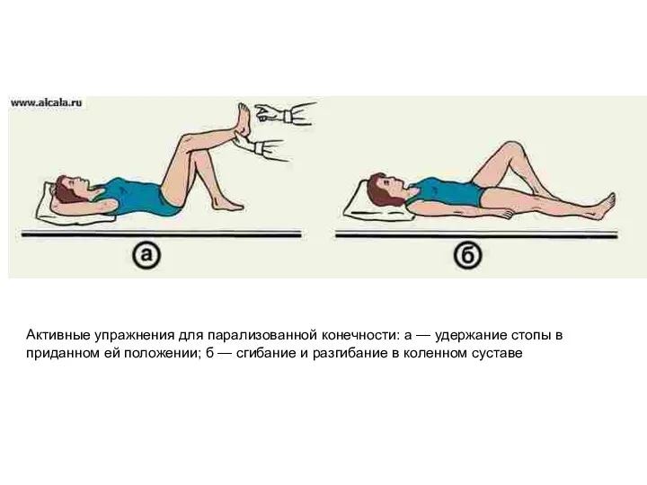 Активные упражнения для парализованной конечности: а — удержание стопы в приданном ей положении;