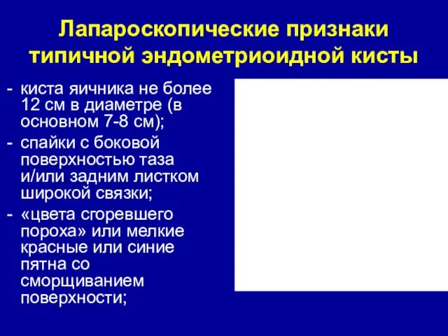 Лапароскопические признаки типичной эндометриоидной кисты киста яичника не более 12