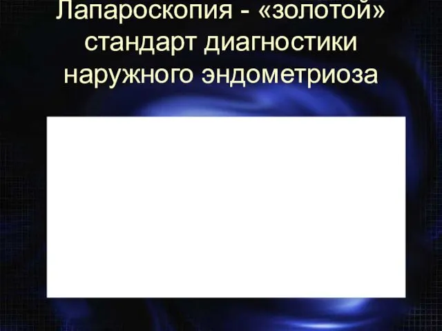 Лапароскопия - «золотой» стандарт диагностики наружного эндометриоза