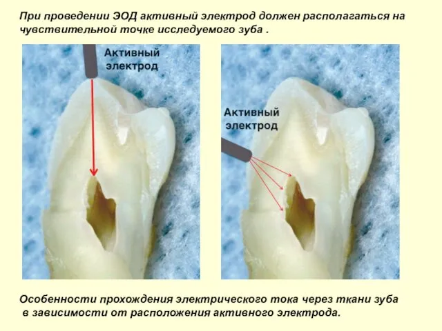 Особенности прохождения электрического тока через ткани зуба в зависимости от