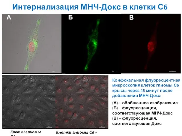 А Б В Конфокальная флуоресцентная микроскопия клеток глиомы С6 крысы