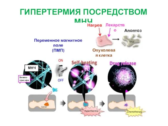 ГИПЕРТЕРМИЯ ПОСРЕДСТВОМ МНЧ Переменное магнитное поле (ПМП) Нагрев Лекарство Апоптоз Опухолевая клетка