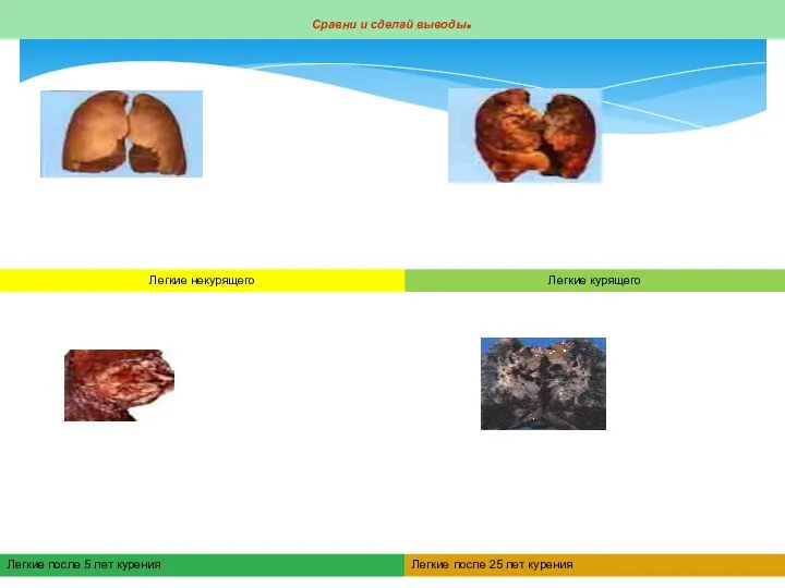 Сравни и сделай выводы. Легкие некурящего Легкие курящего Легкие после