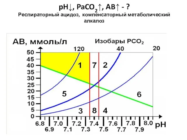 pH↓, PaCO2↑, AB↑ - ? Респираторный ацидоз, компенсаторный метаболический алкалоз
