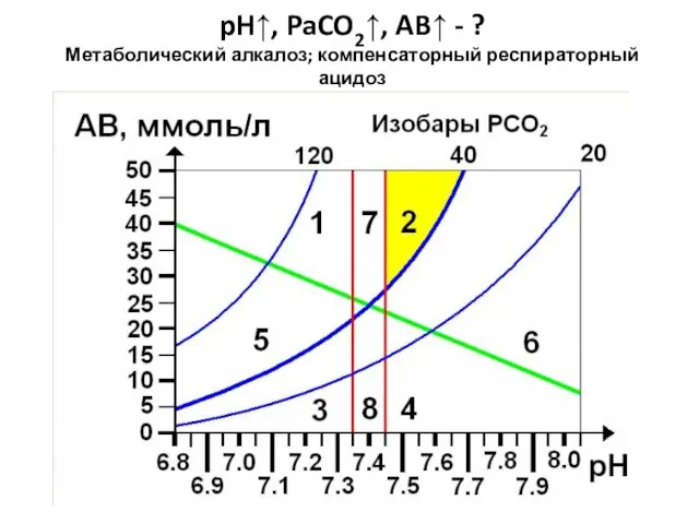 pH↑, PaCO2↑, AB↑ - ? Метаболический алкалоз; компенсаторный респираторный ацидоз