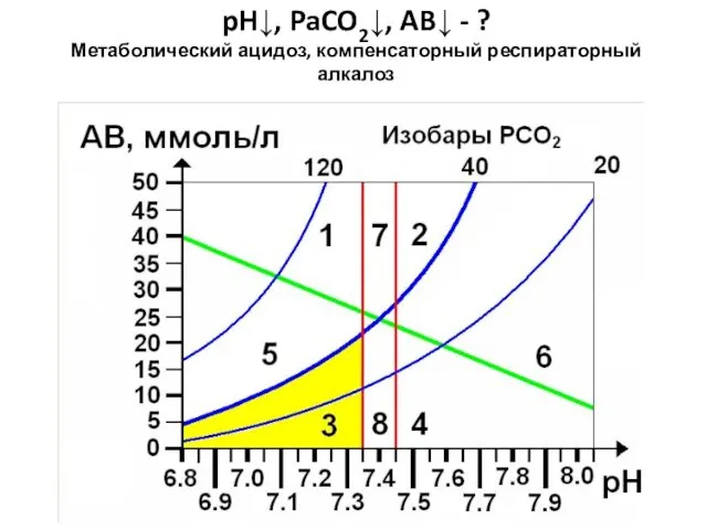 pH↓, PaCO2↓, AB↓ - ? Метаболический ацидоз, компенсаторный респираторный алкалоз