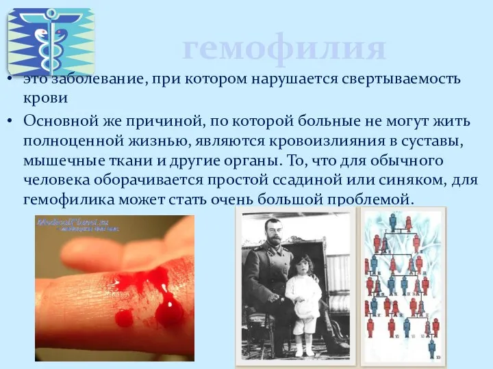 гемофилия это заболевание, при котором нарушается свертываемость крови Основной же