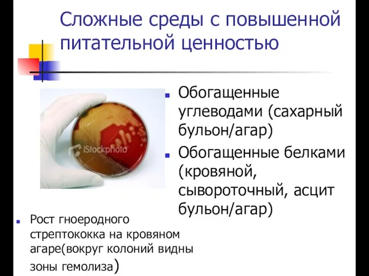 Сложные среды с повышенной питательной ценностью Обогащенные углеводами (сахарный бульон/агар)