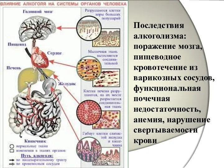 Последствия алкоголизма: поражение мозга, пищеводное кровотечение из варикозных сосудов, функциональная почечная недостаточность, анемия, нарушение свертываемости крови