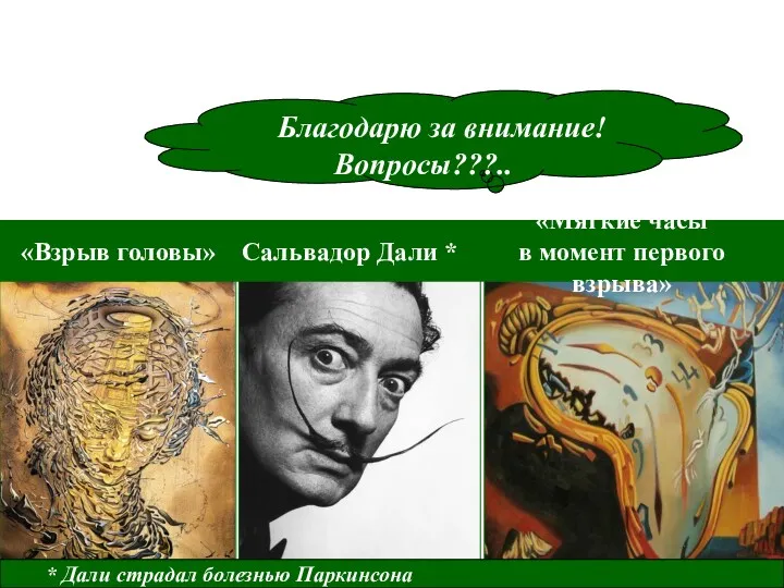 Благодарю за внимание! Вопросы???.. «Взрыв головы» Сальвадор Дали * * Дали страдал болезнью