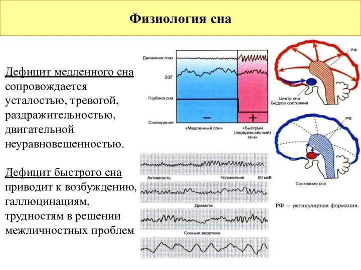 Физиология сна Дефицит медленного сна сопровождается усталостью, тревогой, раздражительностью, двигательной неуравновешенностью. Дефицит быстрого