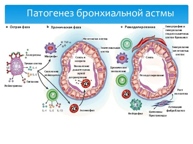 Патогенез бронхиальной астмы