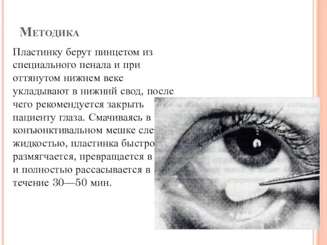 Методика Пластинку берут пинцетом из специального пенала и при оттянутом