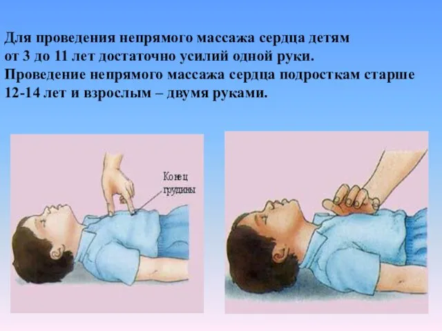 Для проведения непрямого массажа сердца детям от 3 до 11