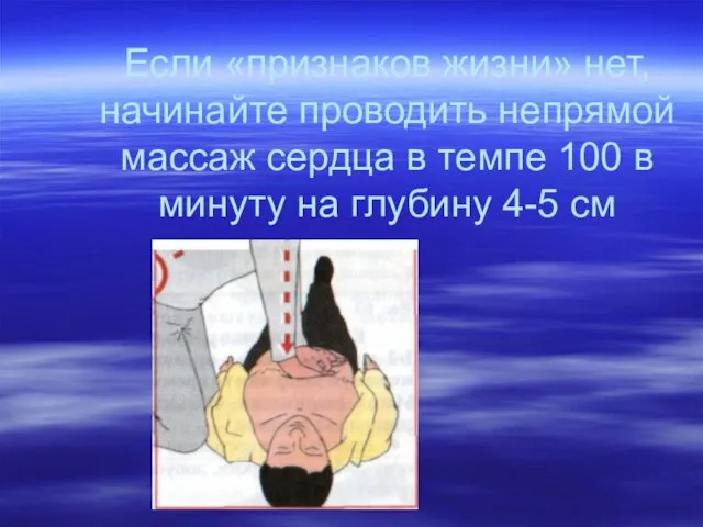 Если «признаков жизни» нет, начинайте проводить непрямой массаж сердца в