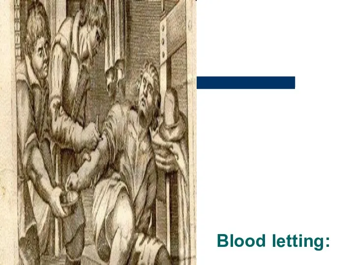 Blood letting: