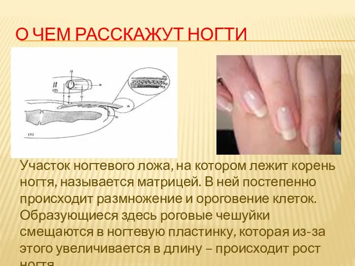 О чем расскажут ногти Участок ногтевого ложа, на котором лежит корень ногтя, называется
