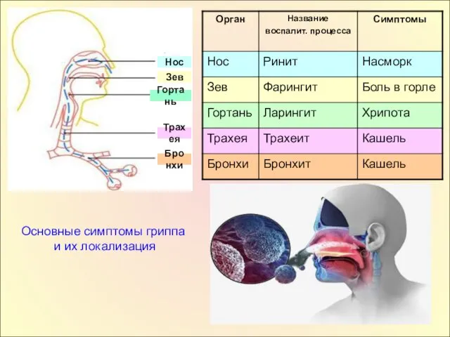 Нос Зев Гортань Трахея Бронхи Основные симптомы гриппа и их локализация