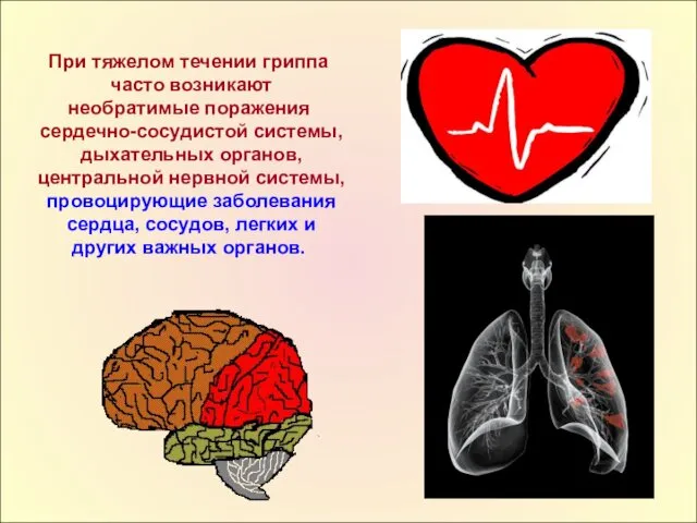 При тяжелом течении гриппа часто возникают необратимые поражения сердечно-сосудистой системы,