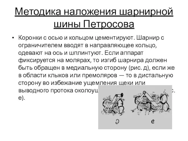 Методика наложения шарнирной шины Петросова Коронки с осью и кольцом
