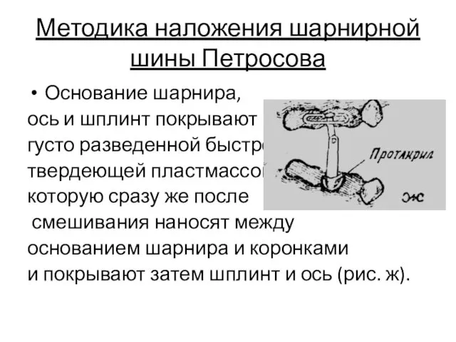 Методика наложения шарнирной шины Петросова Основание шарнира, ось и шплинт
