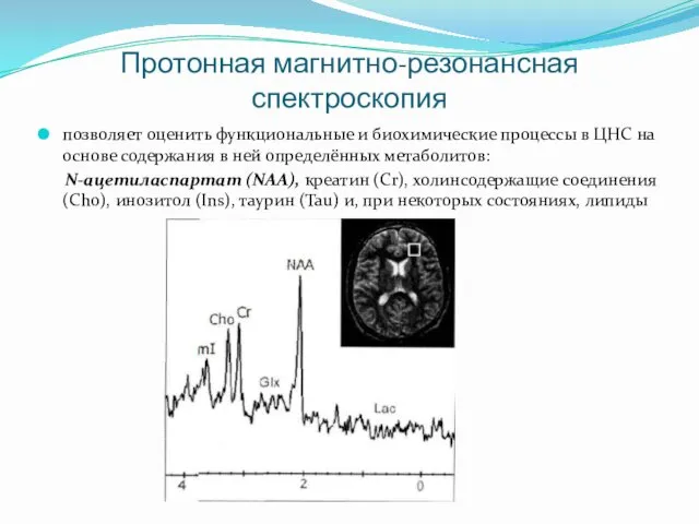 Протонная магнитно-резонансная спектроскопия позволяет оценить функциональные и биохимические процессы в