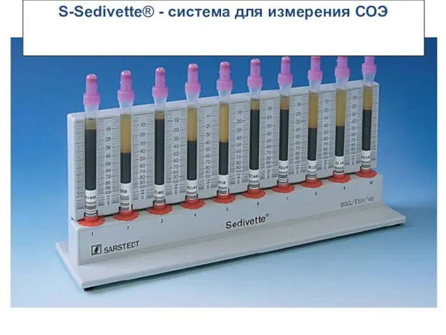 S-Sedivette® - система для измерения СОЭ
