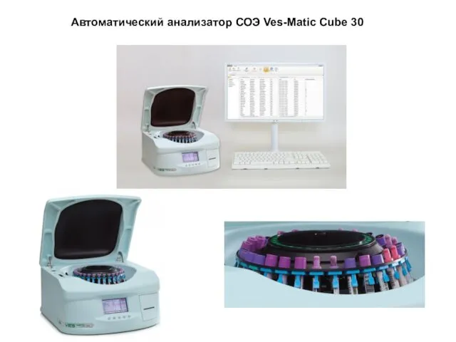 Автоматический анализатор СОЭ Ves-Matic Cube 30