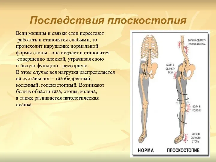 Последствия плоскостопия Если мышцы и связки стоп перестают работать и