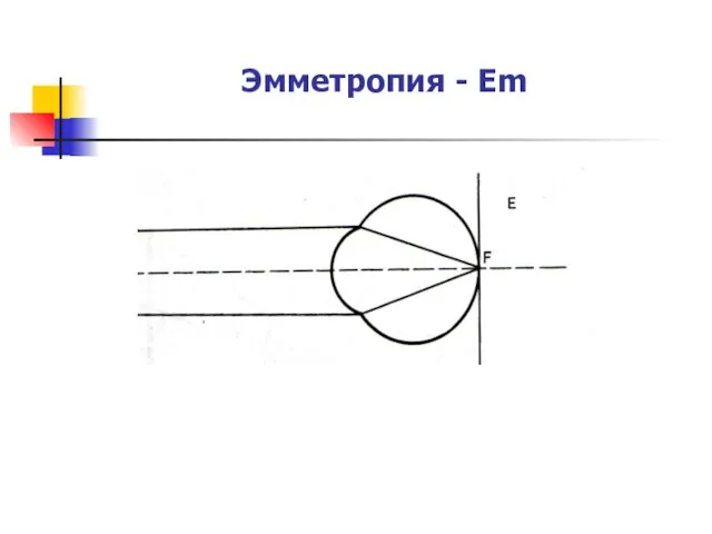 Эмметропия - Em