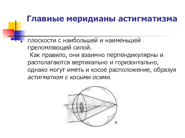 Главные меридианы астигматизма плоскости с наибольшей и наименьшей преломляющей силой.