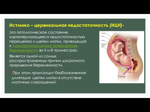 Истмико – цервикальная недостаточность (ИЦН)- это патологическое состояние, характеризующееся недостаточностью