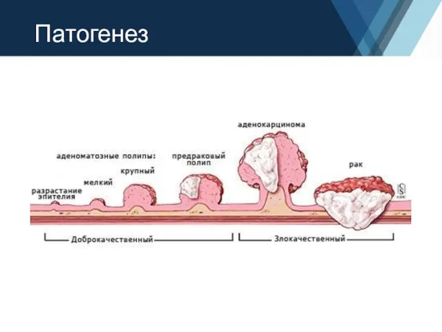 Патогенез